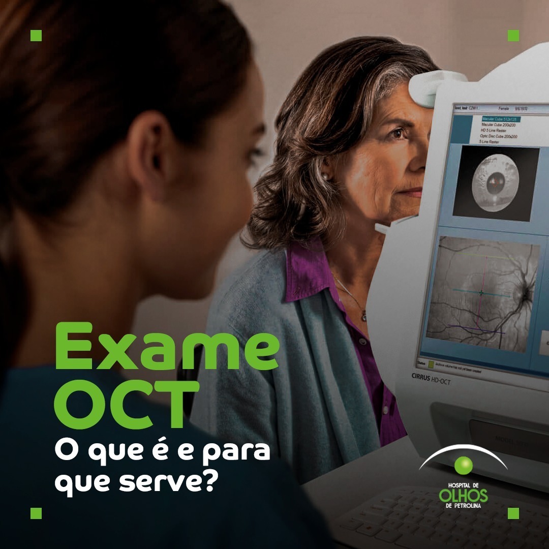 Exame OCT, para que serve?
