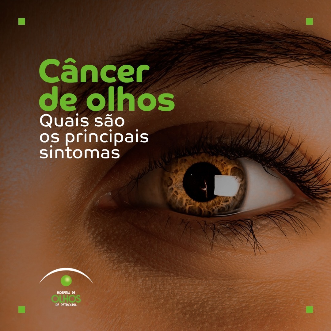 Principais sintomas de câncer de olhos