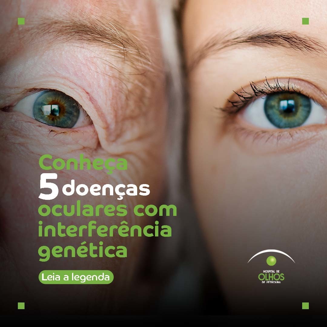 5 doenças oculares com interferência genética