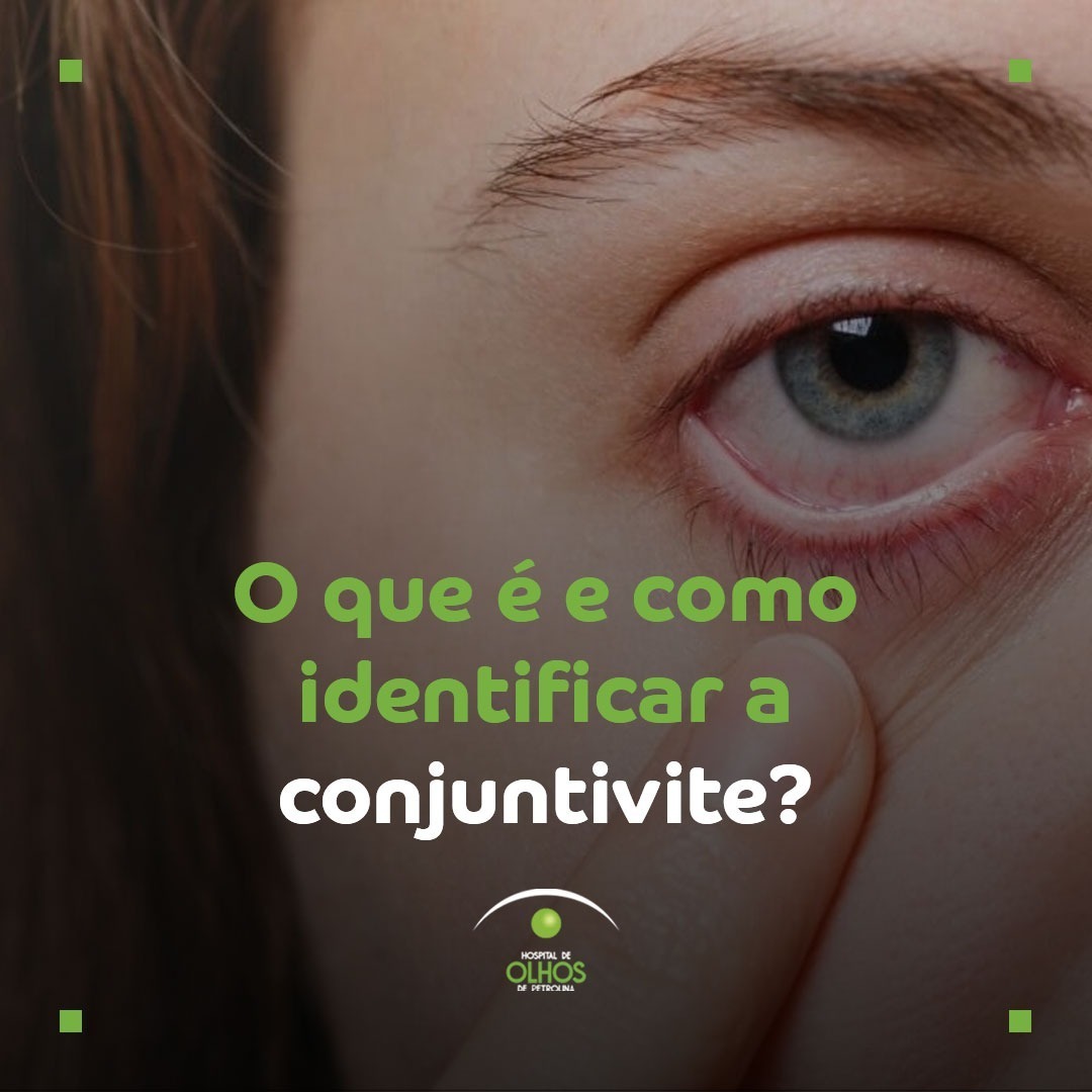 O que é e como identificar a Conjuntivite