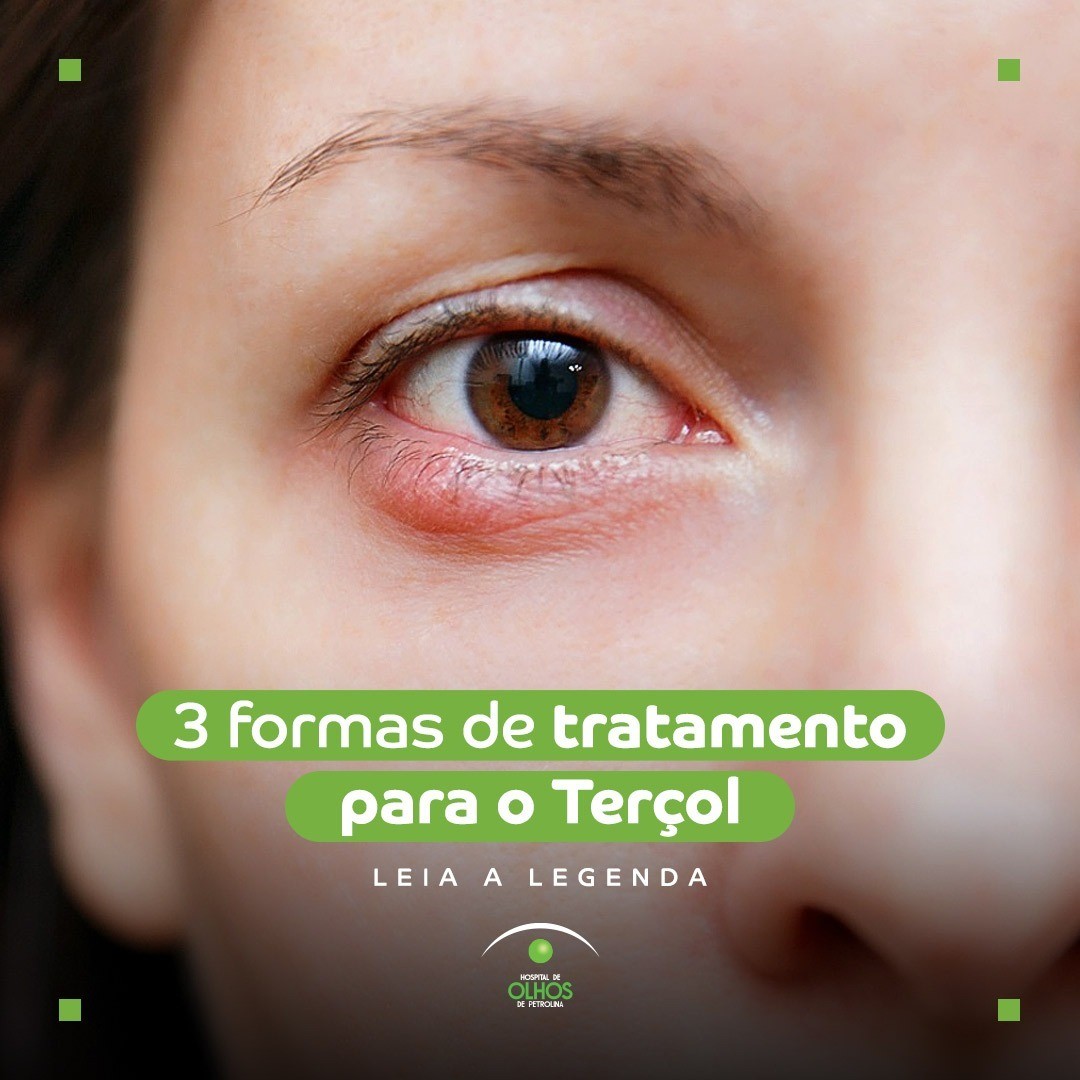 Tratamento adequado ao Terçol