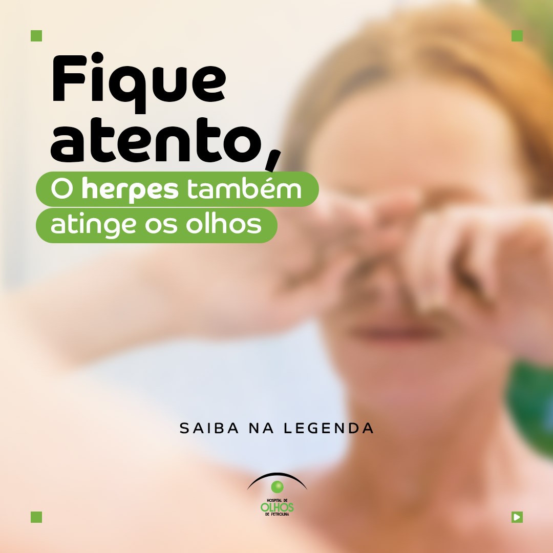 Herpes também atinge os olhos