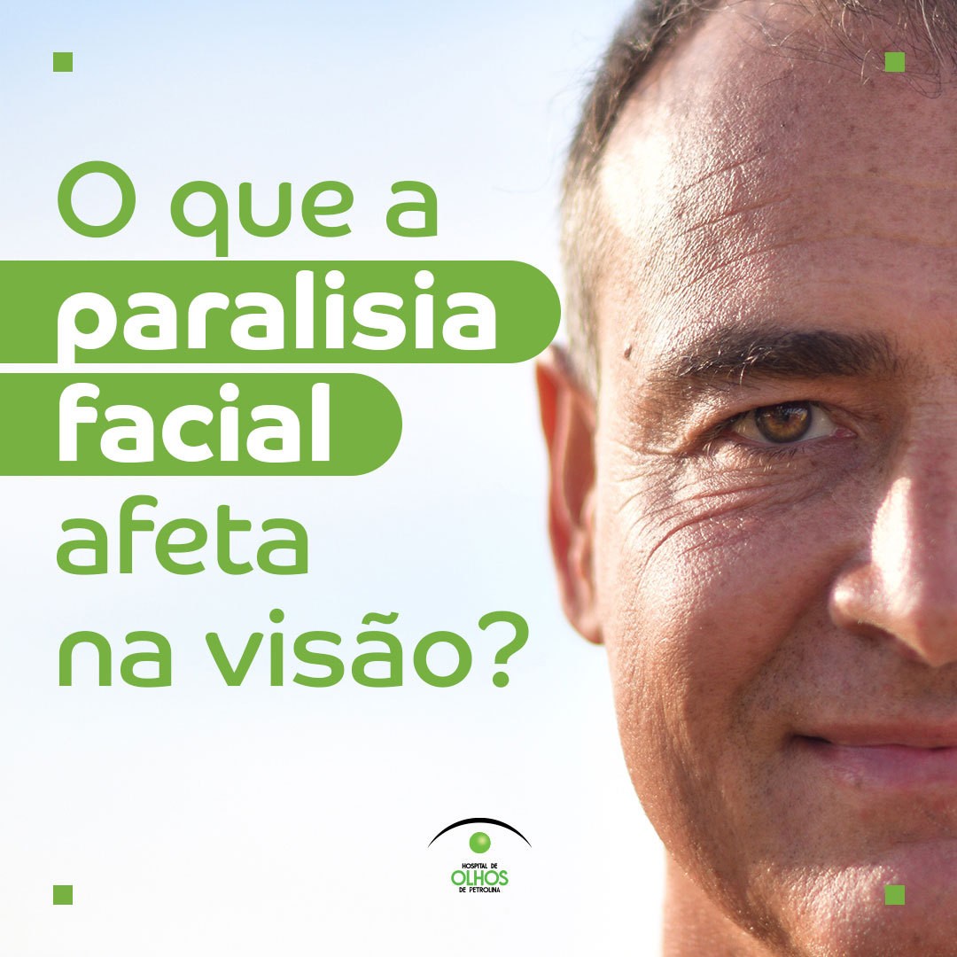 O que a paralisia facial afeta na visão?