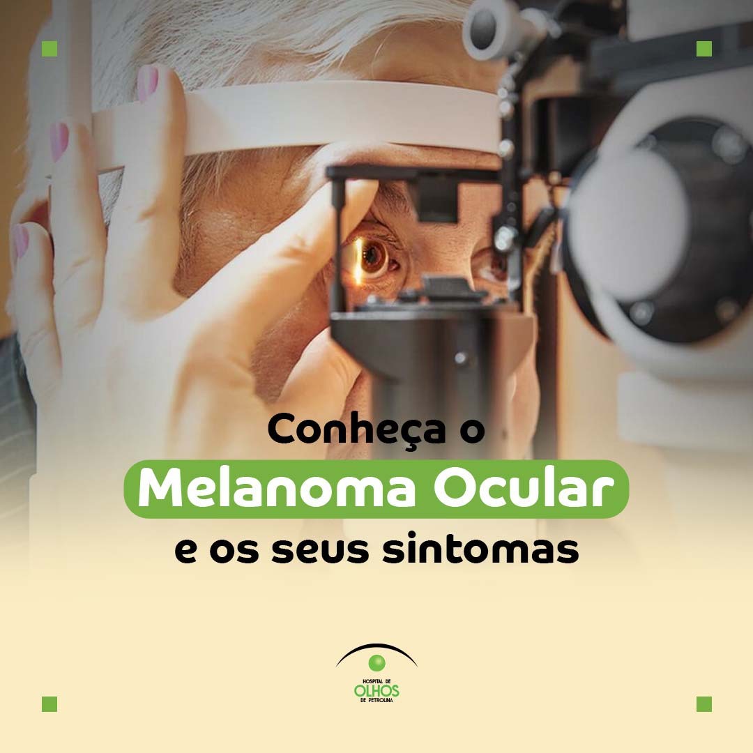 Conheça o Melanoma Ocular e os seus sintomas