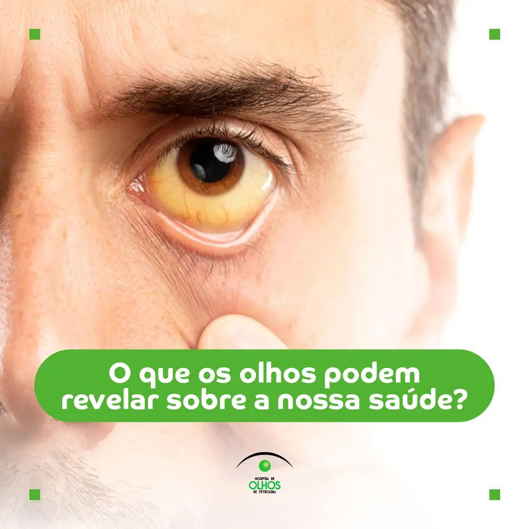 O que os olhos podem revelar sobre a nossa saúde?