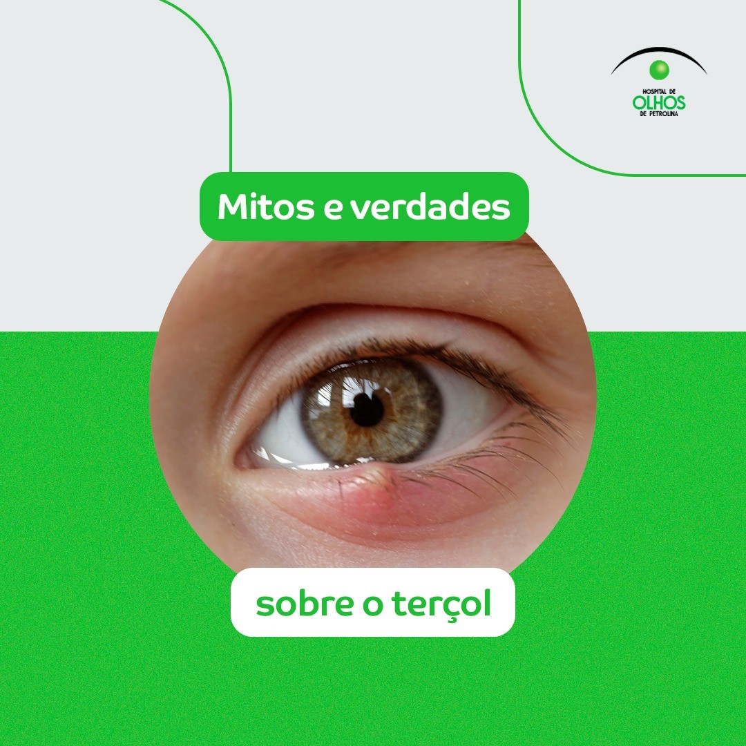 Mitos e verdades sobre o terçol