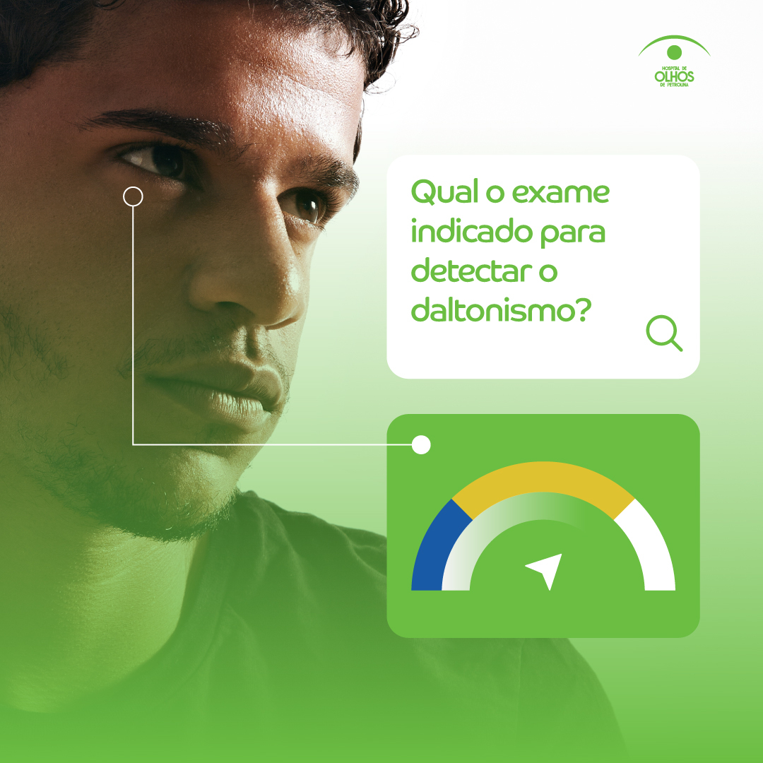 Exame indicado para Daltonismo